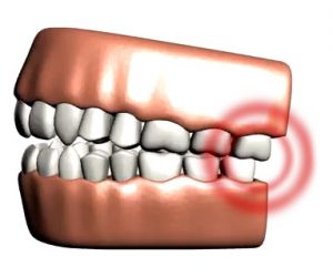 A graphic illustrating the negative impact of TMJ.