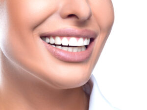 A woman smiling with perfect teeth from cosmetic dentistry.