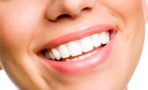 Laughing woman smile with perfectly white teeth.