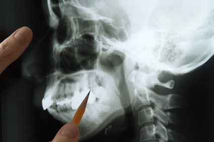 An image of a jawbone being examined by a dentist.