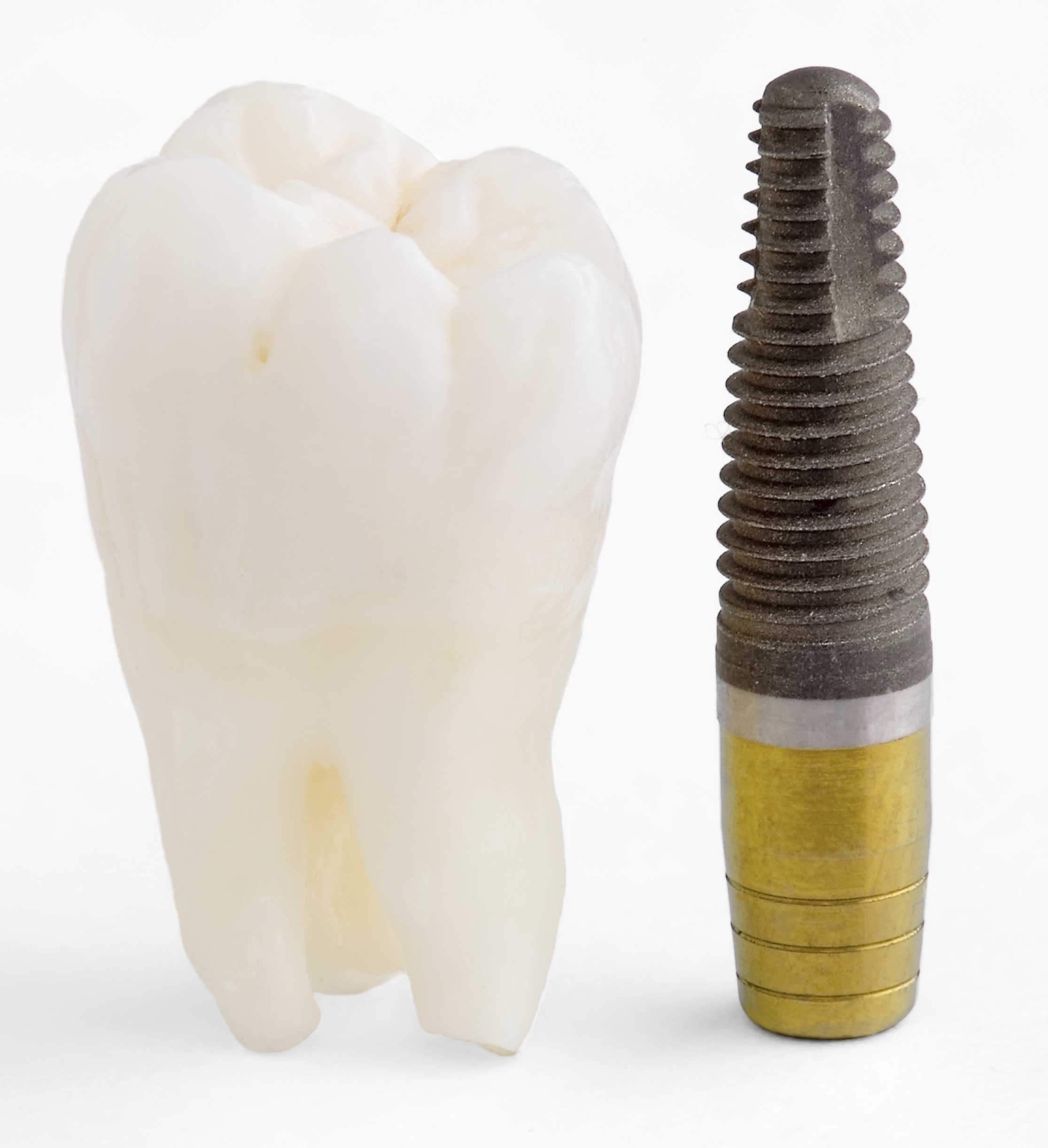 A dental implant base next to a tooth, a common treatment for tooth loss in Kennesaw.